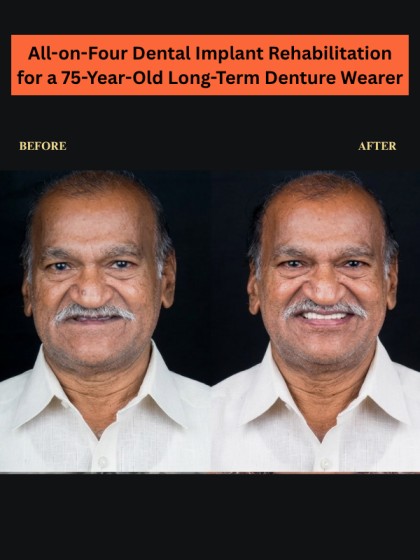 Implant Result 3