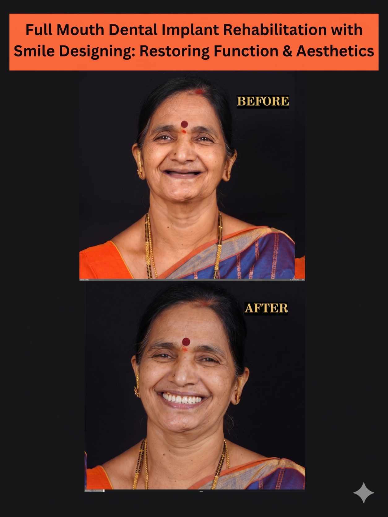Implant Result 2